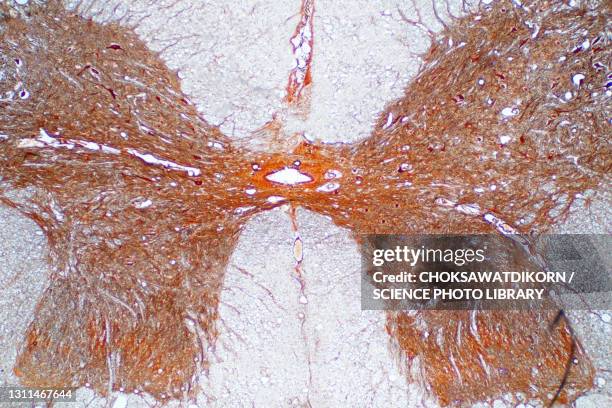 spinal cord, light micrograph - light micrograph stock pictures, royalty-free photos & images