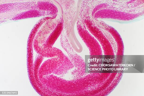 dog roundworm eggs, light micrograph - roundworm stock pictures, royalty-free photos & images