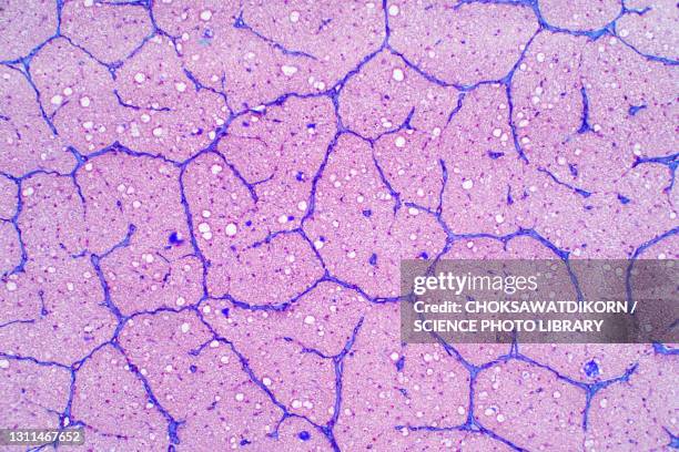 human optic nerve, light micrograph - light micrograph stock pictures, royalty-free photos & images