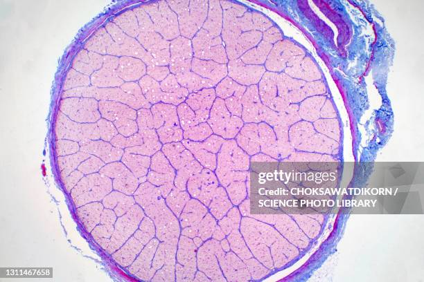human optic nerve, light micrograph - optic nerve cells stock pictures, royalty-free photos & images