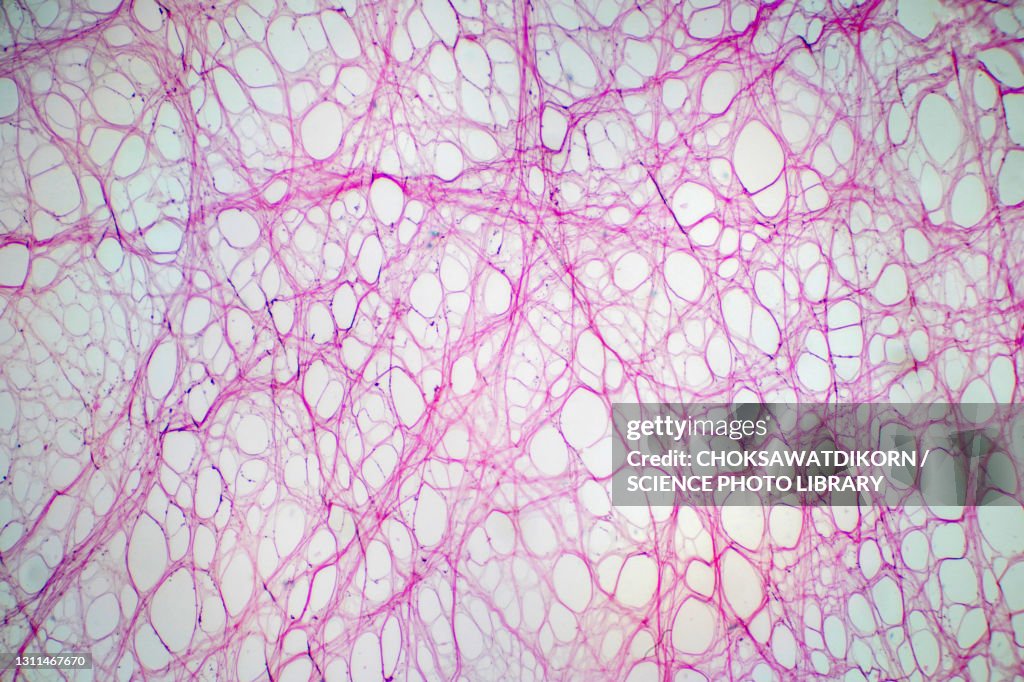 Areolar connective tissue, light micrograph