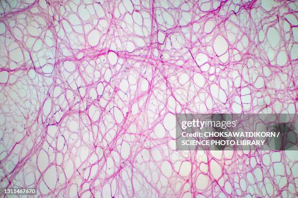 areolar connective tissue, light micrograph - fibroblasto imagens e fotografias de stock