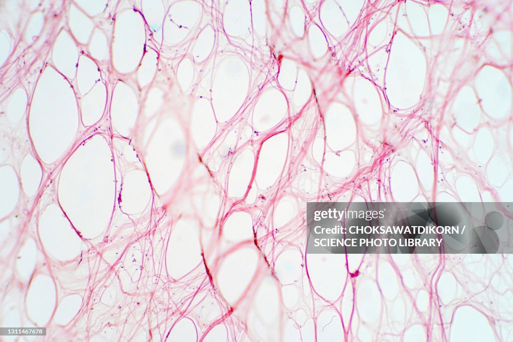 Areolar connective tissue, light micrograph