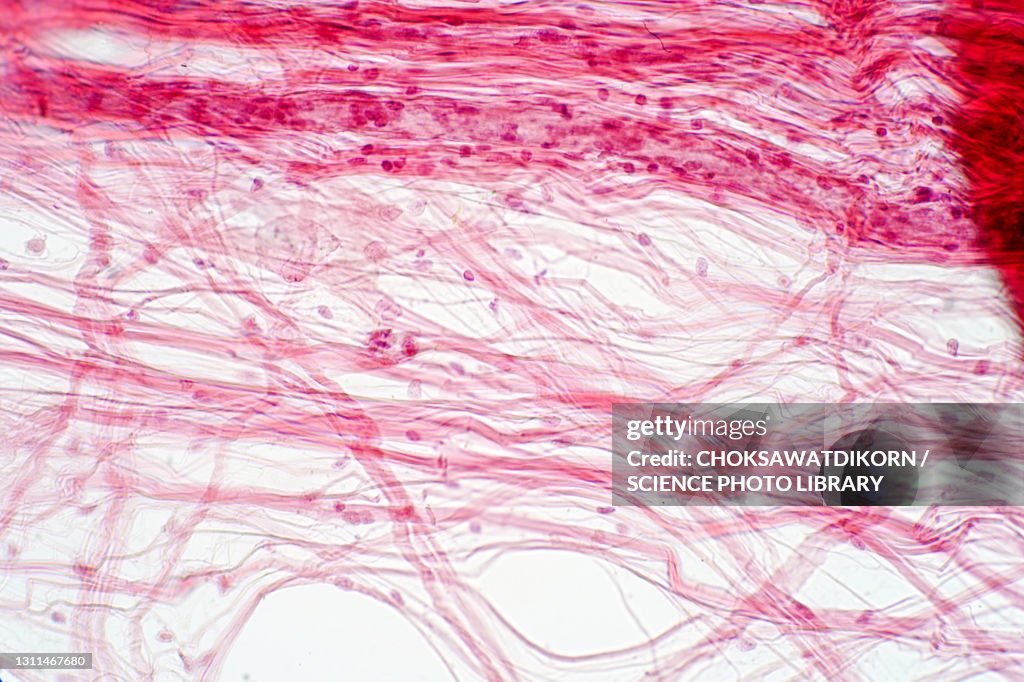 Areolar connective tissue, light micrograph