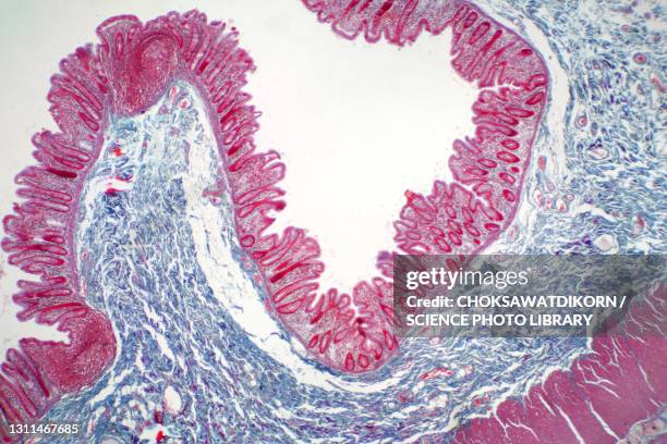 human large intestine, light micrograph - histologia - fotografias e filmes do acervo