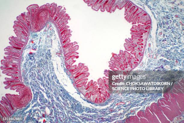 human large intestine, light micrograph - histology 個照片及圖片檔