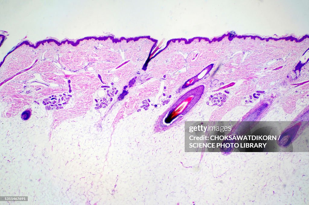 Human scalp, light micrograph