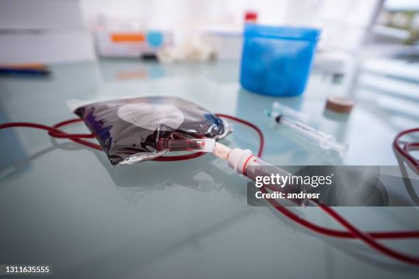 blood donation bag - cateter imagens e fotografias de stock