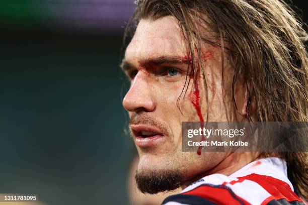 Angus Crichton of the Roosters bleeds from a cut on his brow during the round five NRL match between the Sydney Roosters and the Cronulla Sharks at...