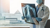 Lung disease, covid-19, asthma or bone cancer illness with doctor diagnosing patientâs health with radiological chest x-ray film for medical healthcare hospital service