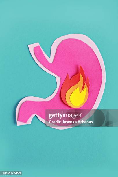 stomach heartburn - reflux stock-fotos und bilder