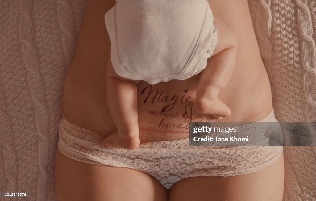 C-section scar on a woman's body