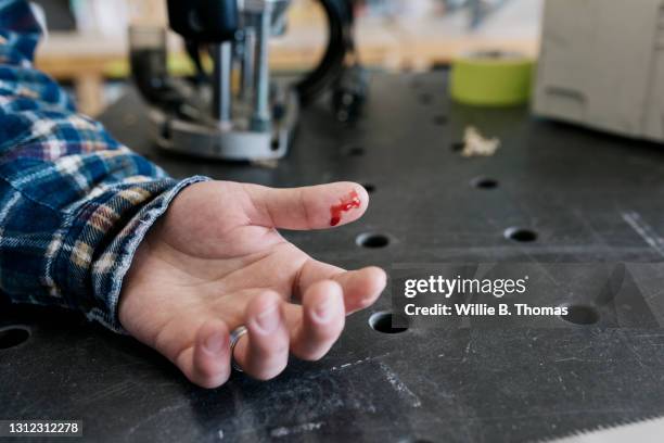 young man with a cut on finger while wood working - hand laceration stockfoto's en -beelden