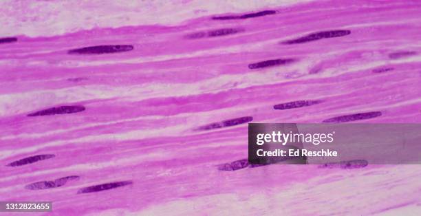 smooth muscle cells (or fibers)---nonstriated, involuntary muscle, 250x - glad spierweefsel stockfoto's en -beelden