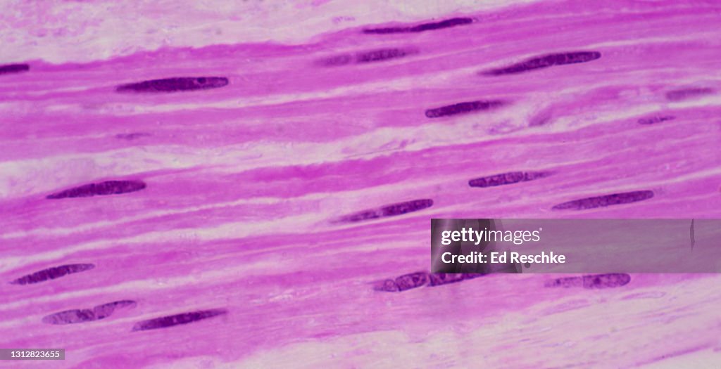 SMOOTH MUSCLE CELLS (or FIBERS)---NONSTRIATED, INVOLUNTARY MUSCLE, 250X