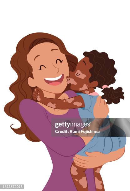 kissing mom with love - vitiligo stock illustrations