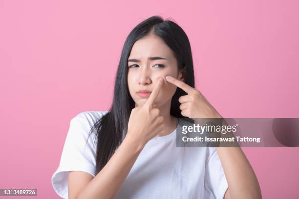 asian woman squeezes acne on a pink background - prevention ストックフォトと画像