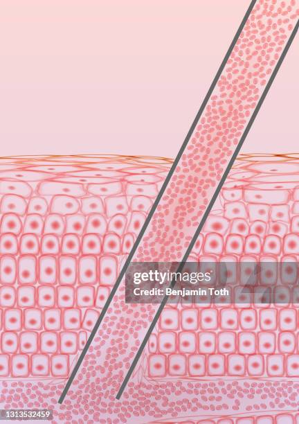 illustrations, cliparts, dessins animés et icônes de prise de sang, phlébotomie, aiguille dans la section transversale des tissus veineux et globules rouges - couche moyenne de la peau