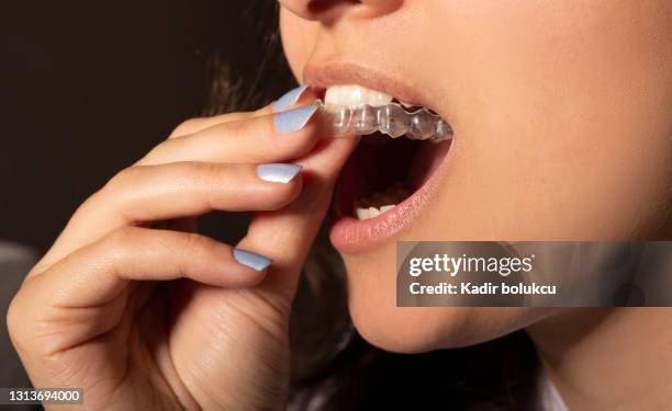 i̇nvisible braces. - invisible stock pictures, royalty-free photos & images