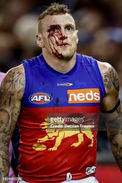 Mitch Robinson of the Lions comes off under the blood rule during the round six AFL match between the Carlton Blues and the Brisbane Lions at Marvel...