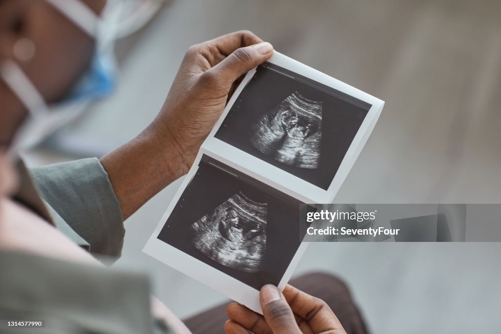 Het beeld van de ultrasone klank in de hand van de vrouw