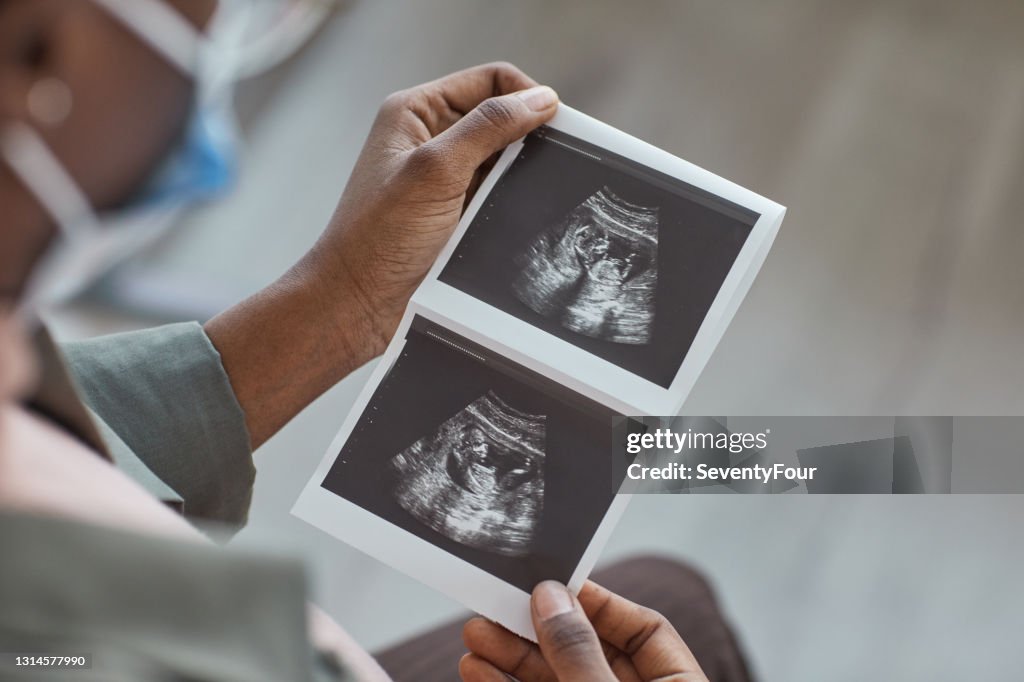 Ultrasound image in woman's hand