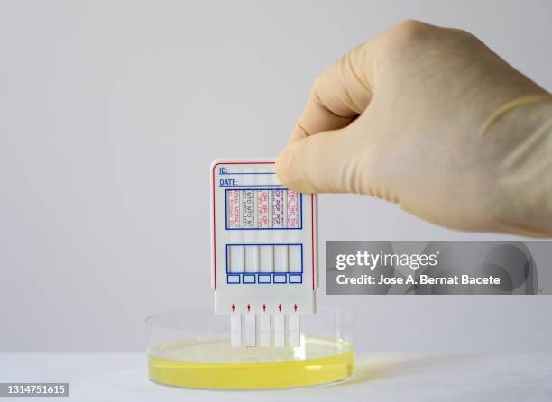 hand of a doctor conducting a test multi-drug screening kit for testing urine on a white background. - drug testing stock pictures, royalty-free photos & images