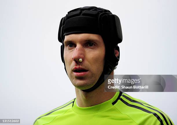 Petr Cech of Chelsea looks on after injuring his nose during the Barclays Premier League match between Blackburn Rovers and Chelsea at Ewood Park on...