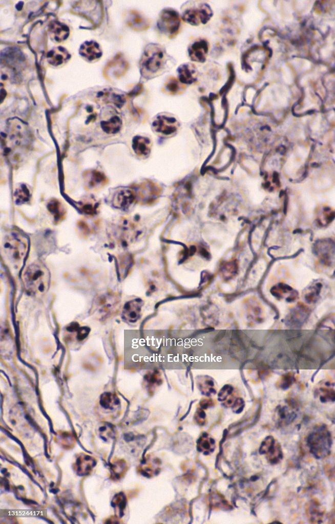 Connective Tissue--RETICULAR CONNECTIVE, LYMPYH NODE, 350X