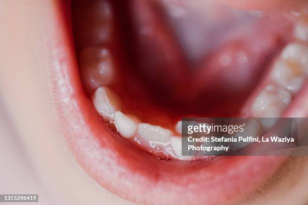 close up on child shark teeth - shark teeth stock-fotos und bilder