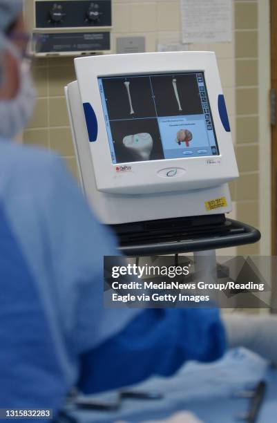 Performing Surgery Using Computer 127 Hospital Computer Tech Stock Photos, High-Res Pictures, and Images ...