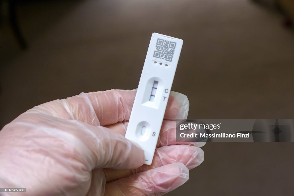 Positive Cassette rapid test for COVID-19, Test Result by Using Rapid Test Device for COVID-19 Novel Coronavirus.