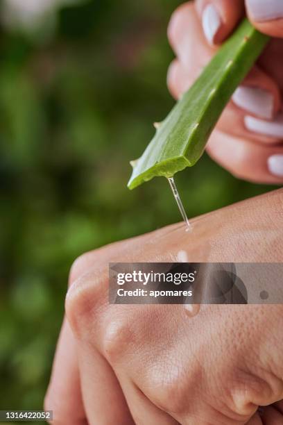 young woman moisturizing her hands with aloe vera natural gel - aloe vera imagens e fotografias de stock