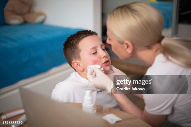 mother cleaning her son's wound on his cheek - healing wound stock pictures, royalty-free photos & images