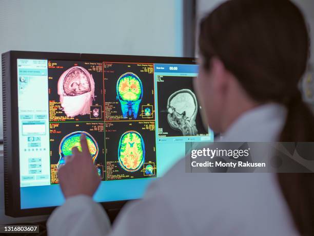 uk, north yorkshire, female doctor looking at mri scanner monitor - kleinhirn stock-fotos und bilder