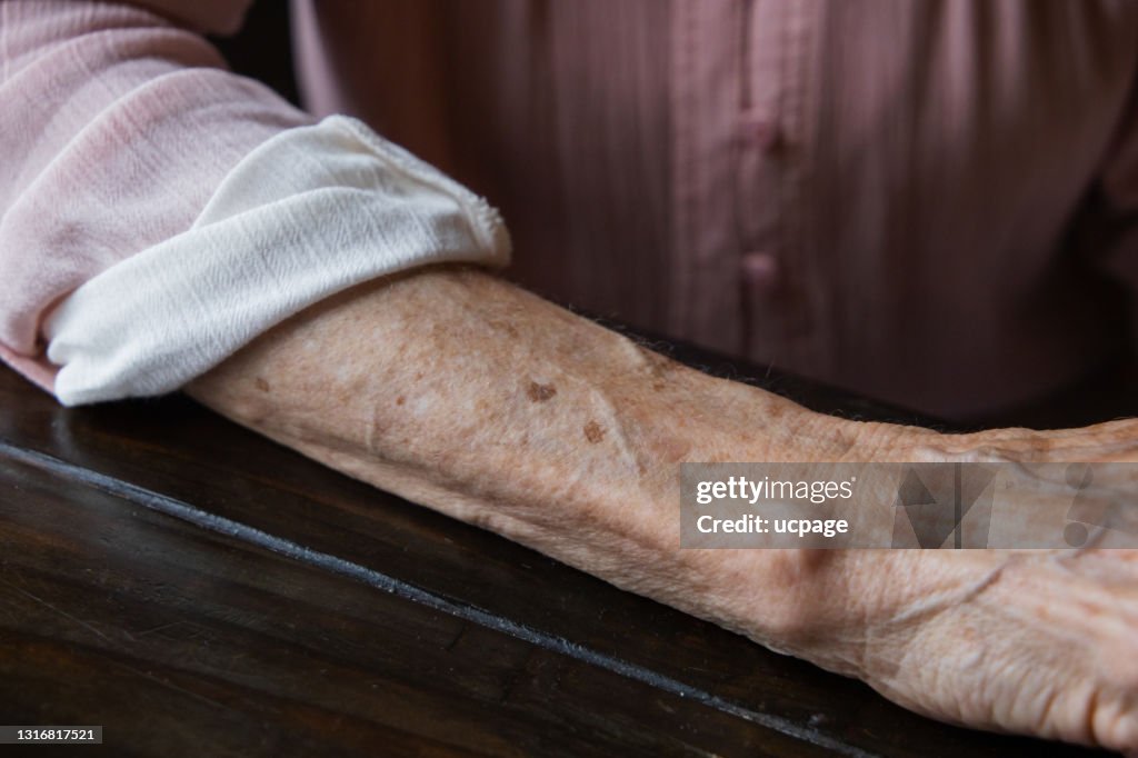 Anf elderly woman grandmother's arm with wrinkles and age spots.