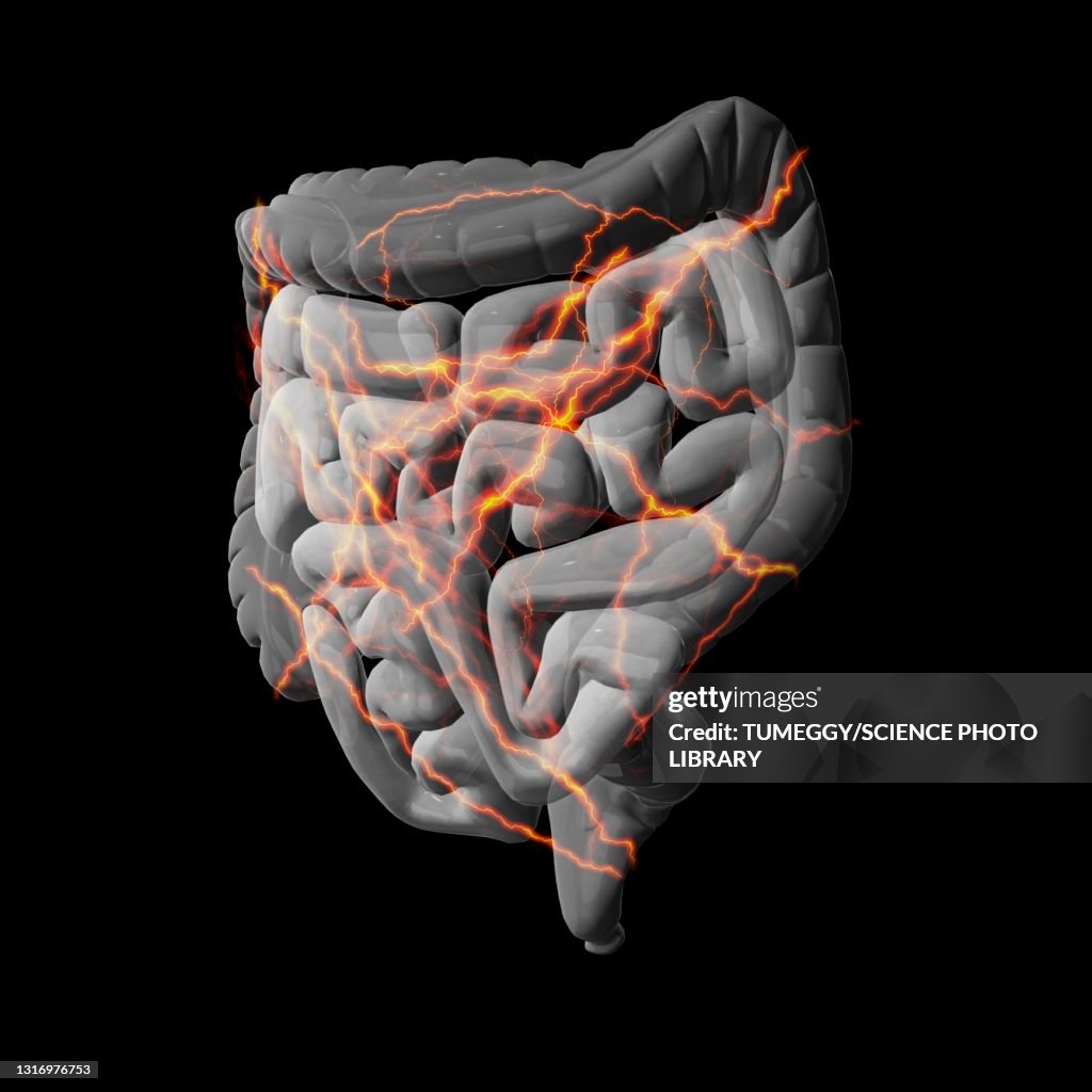 Intestinal pain, conceptual illustration