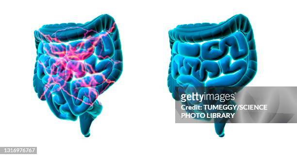 healthy and unhealthy intestines, conceptual illustration - human colon stock illustrations