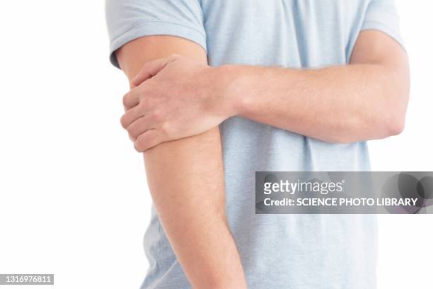 man holding his elbow in pain - mann ellbogen stock-fotos und bilder