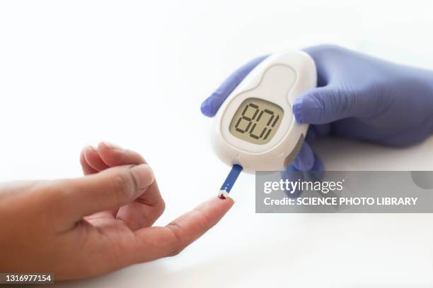 blood glucose test - diabète photos et images de collection