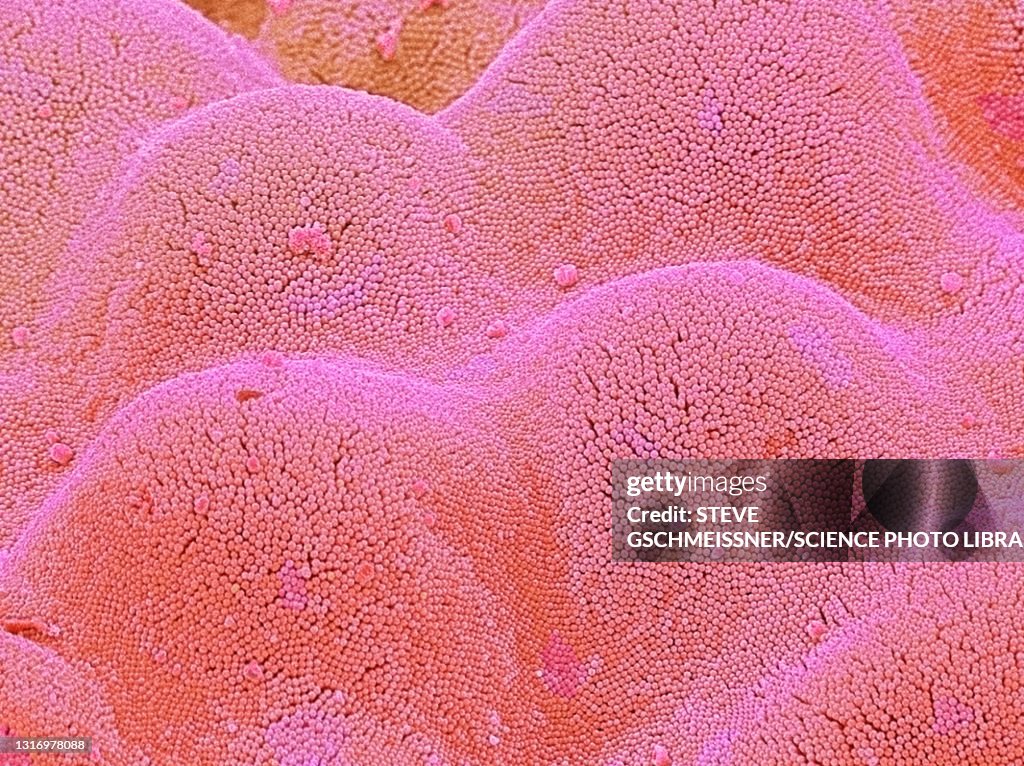 Intestinal microvilli, SEM
