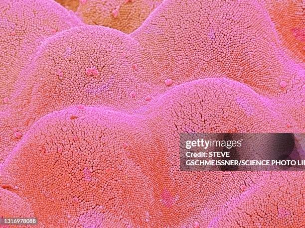 intestinal microvilli, sem - epitel bildbanksfoton och bilder