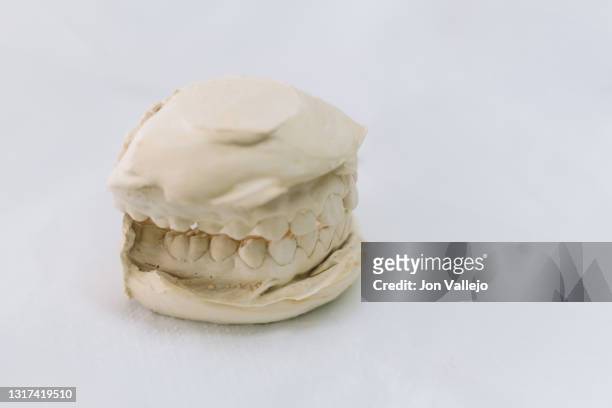 modelo de un molde de escayola de una dentadura. - escayola stock-fotos und bilder