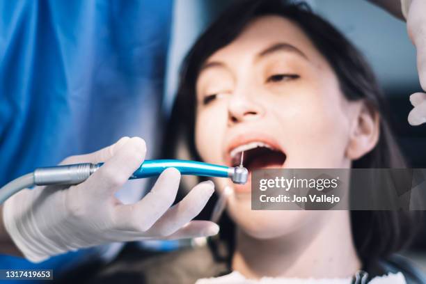 una paciente está con la boca abierta y un tubo de plástico siendo aspirado mientras el dentista sostiene una herramienta eléctrica en la mano. esta herramienta se utilizará para raspar los dientes de la joven. - paciente stock pictures, royalty-free photos & images