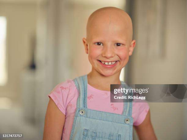 meisje met alopecia die met een vriend speelt - kalend stockfoto's en -beelden