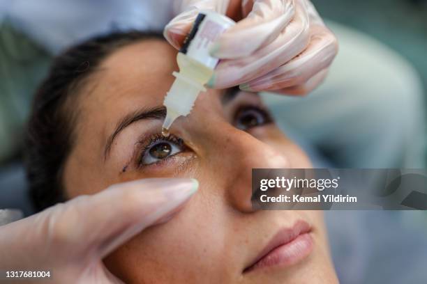 portrait of young woman who had eye lid surgery - colírio imagens e fotografias de stock