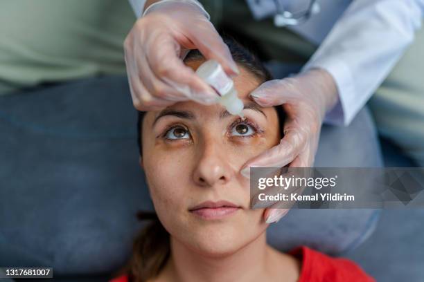 portrait of young woman who had eye lid surgery - colírio imagens e fotografias de stock