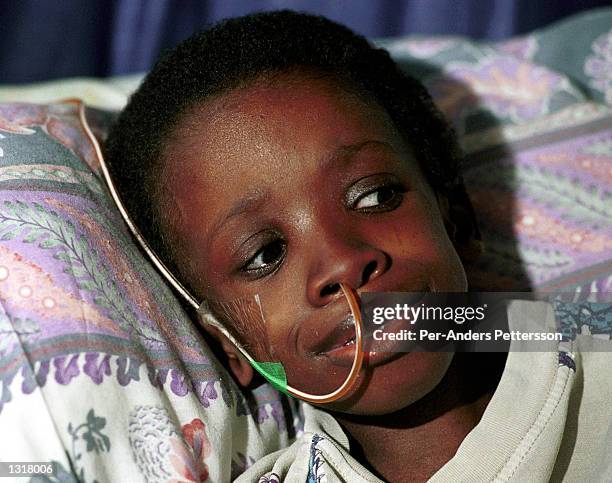 Nkosi Johnson, age 12, rests his head on a pillow in his home February 4, 2001 in Melville a suburb in Johannesburg, South Africa. Nkosi, who was the...