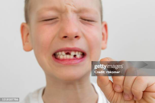 a pulled tooth in the hand of a crying child - losing virginity stock-fotos und bilder