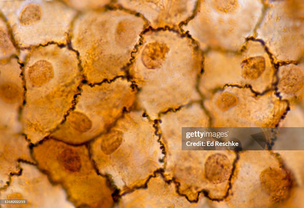 SIMPLE SQUAMOUS EPITHELIUM (MESOTHELIUM) forming part of the PERITONEUM--A SEROUS MEMBRANE THAT LINES THE ABDOMINAL CAVITY, 250X